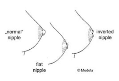 Are My Areolas Too Big? Detailed Explanation of All the Possible